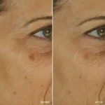 NAD+ CELL ENERGIZING TREATMENT