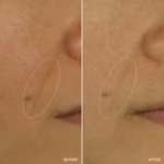 NAD+ CELL ENERGIZING TREATMENT
