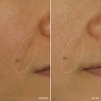 NAD+ CELL ENERGIZING TREATMENT - Image 7