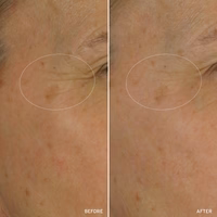 NAD+ CELL ENERGIZING TREATMENT - Image 8