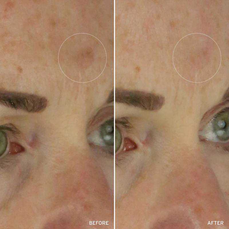 NAD+ CELL ENERGIZING TREATMENT - Image 9