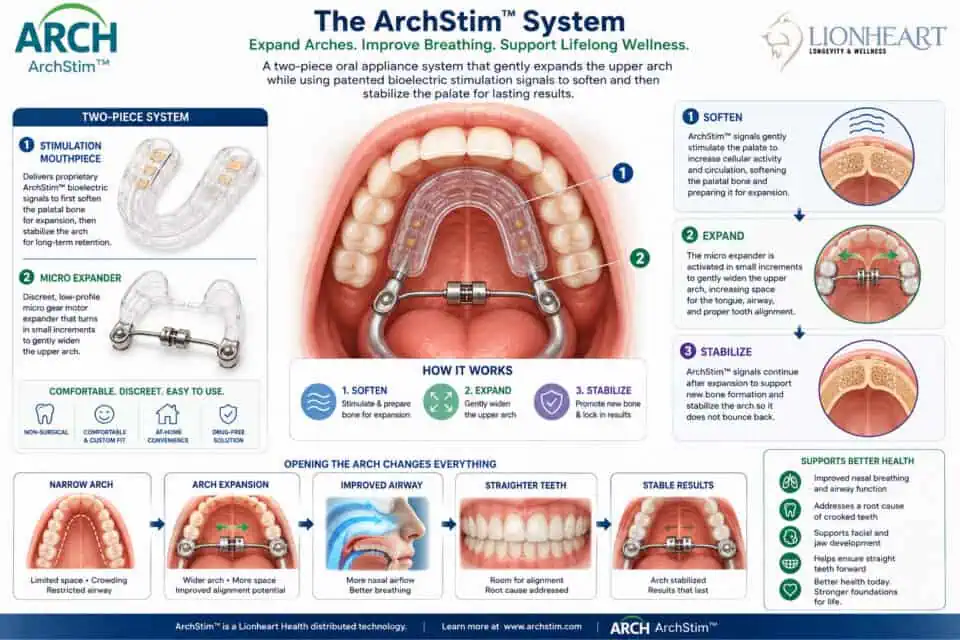 Archstim system