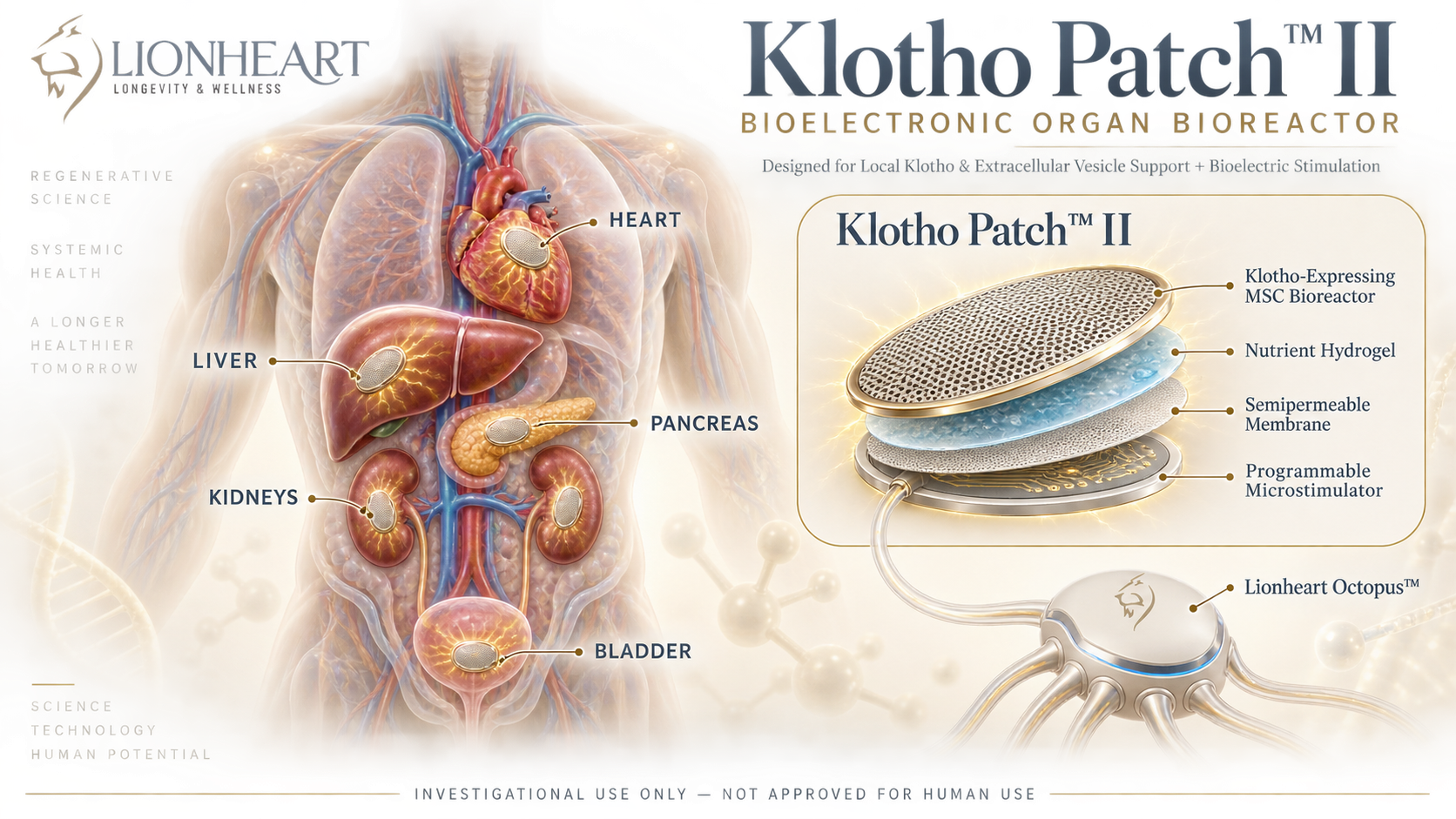Bioreactor