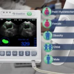 BladGo 2.0 Handheld Bladder Scanner
