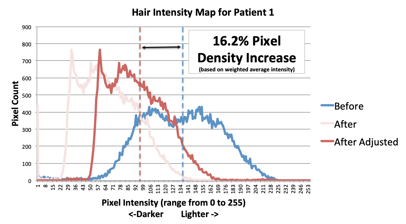 Hair Intensity Map