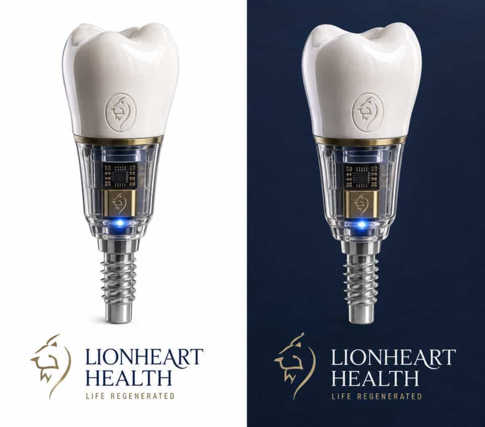 ImplantStim Image
