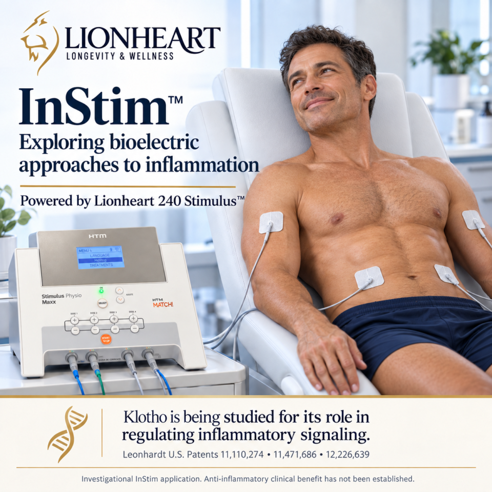 InStim