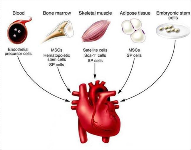 MyoStim Peripheral