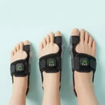 Nexalign Pro EMS Bunion Corrector