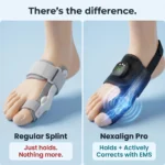 Nexalign Pro EMS Bunion Corrector