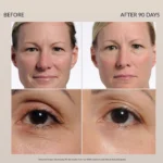 Nira pro laser results