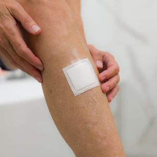Antibacterial Bioelectric Bandage Kit - Image 6