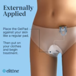Elitone Pelvic Floor Exerciser