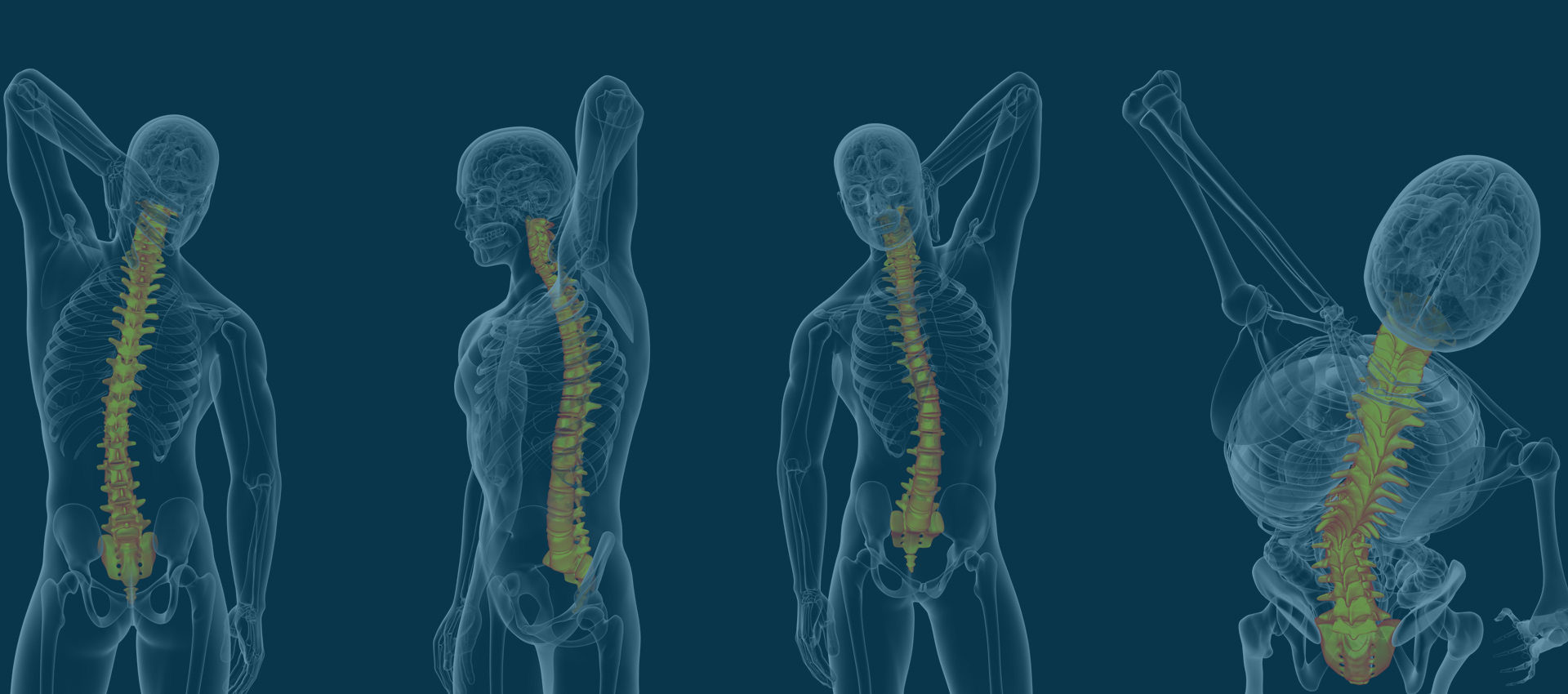 Spine pain