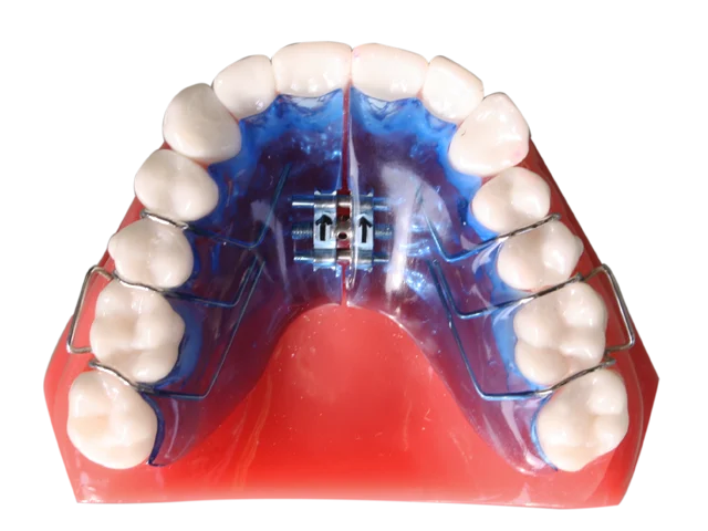 Teeth:Expander
