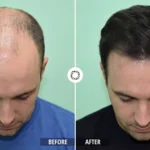 Cura Peptide Hair Growth Serum