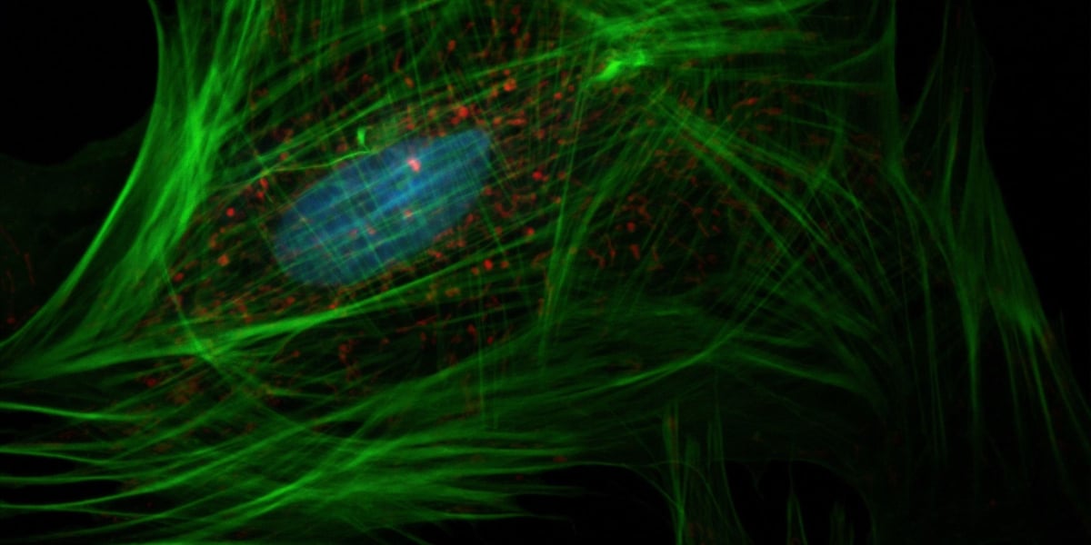 Bioelectri.blog post feature