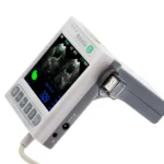 BladGo 2.0 Handheld Bladder Scanner