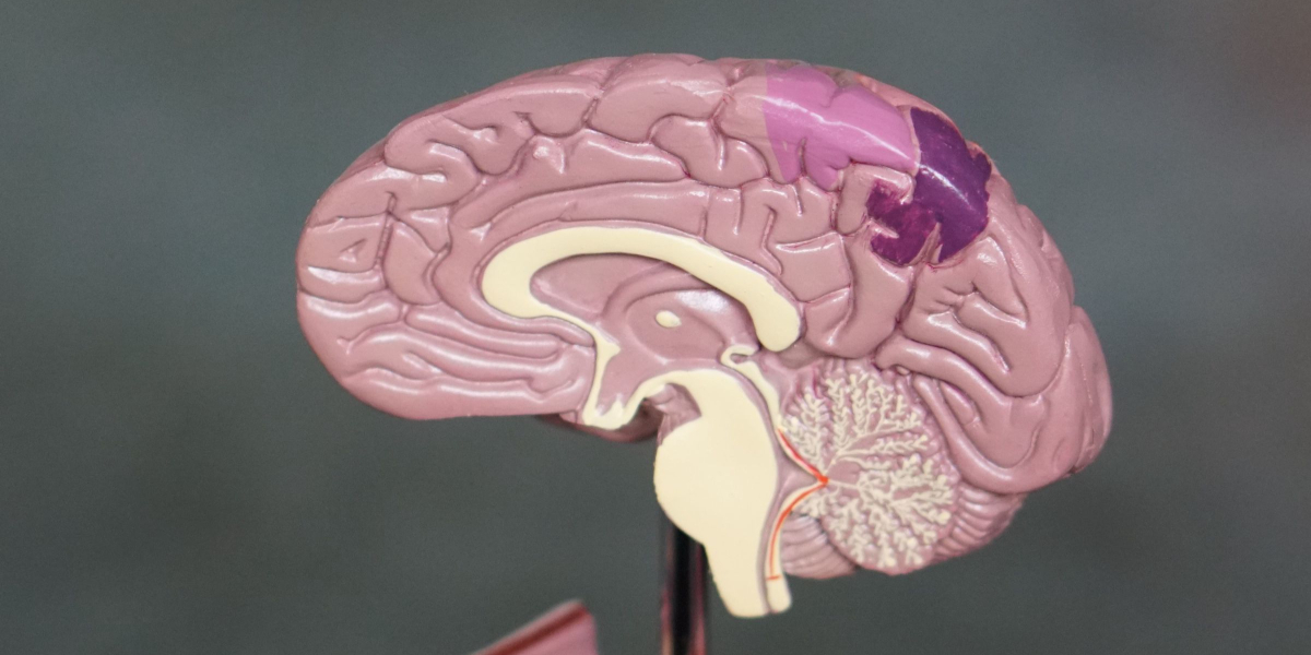 Brain health klotho