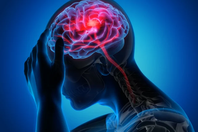 Brainpain