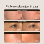 Erythros Laser Pro Mask