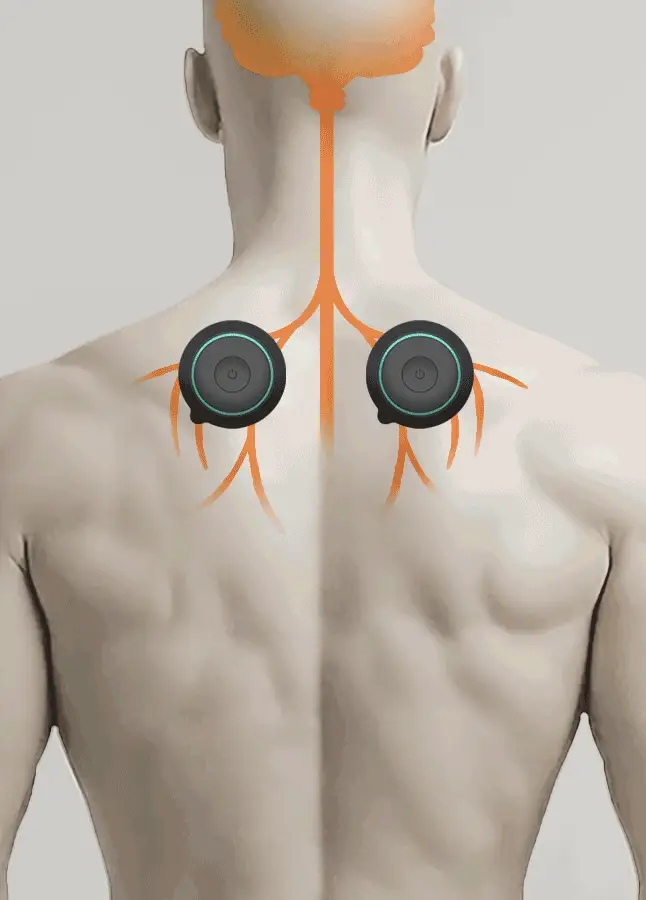 Chirp Halo Wireless Muscle Stim (Double) - Image 6