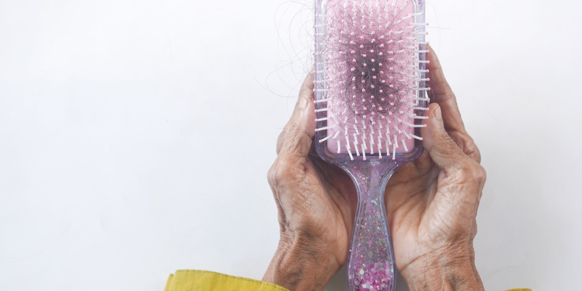 Covid hairloss.blog post feature