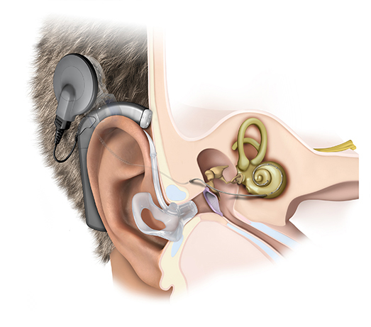 Earcell image