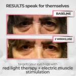Eye results