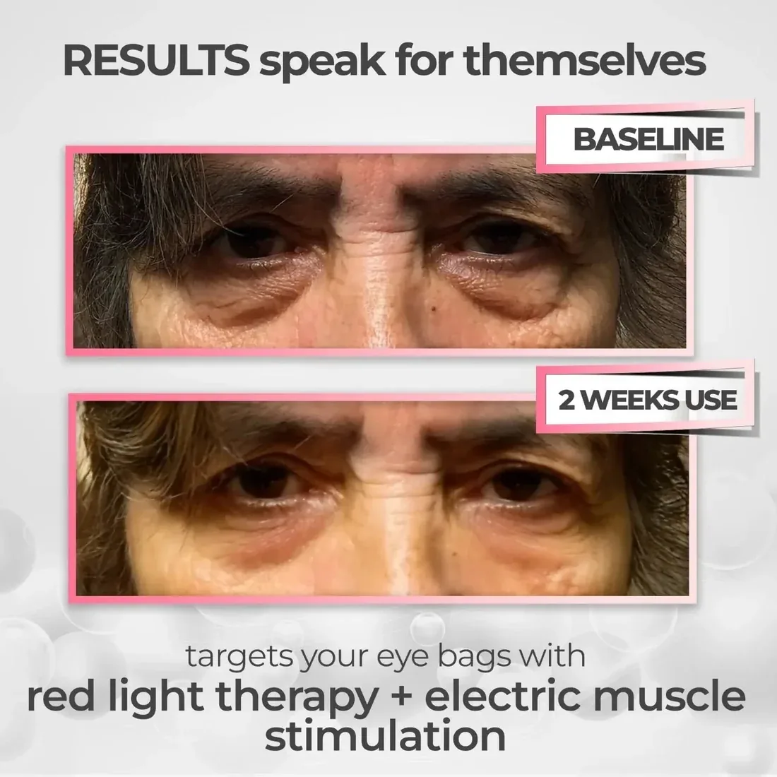 Eye results