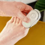 Onychon Antifungal Laser Device