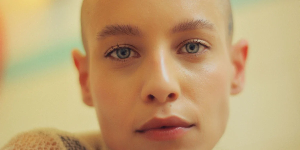 Female hair loss