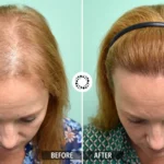 Cura Peptide Hair Growth Serum