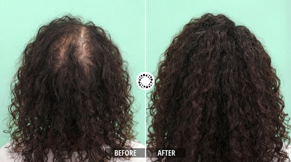Cura Peptide Hair Growth Serum