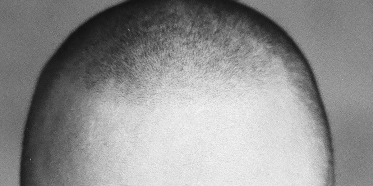 Hair follicle