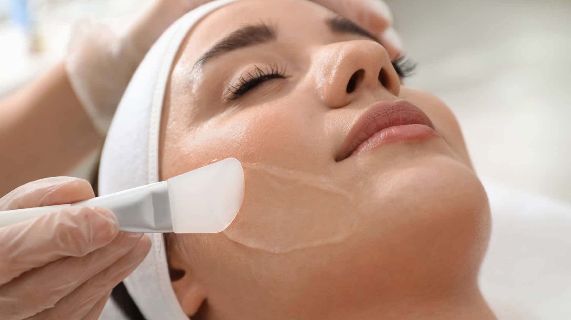 How a chemical peel works