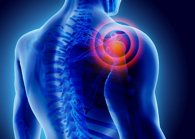 Inflammation point