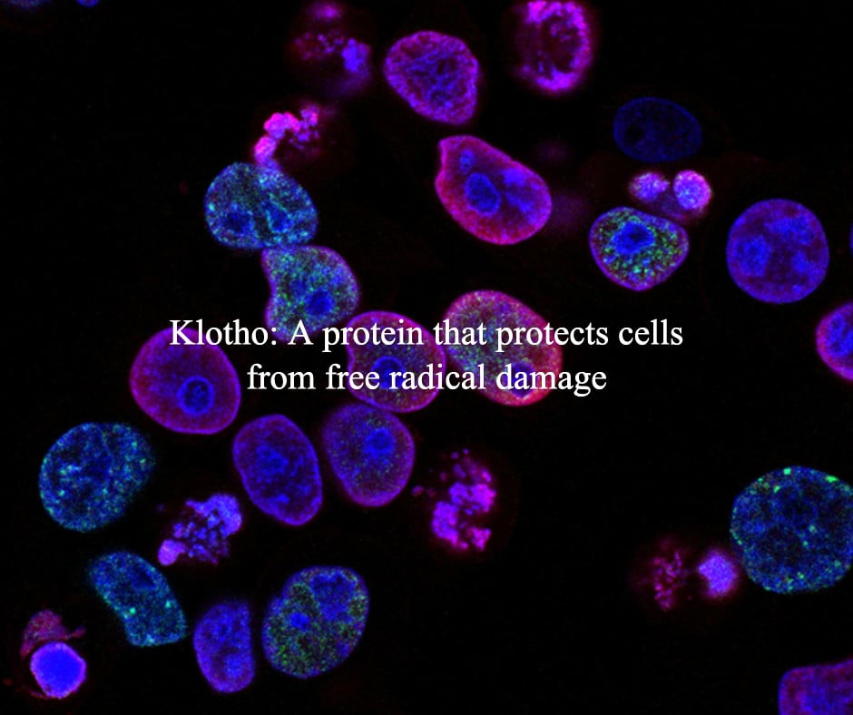 Klotho free radicals
