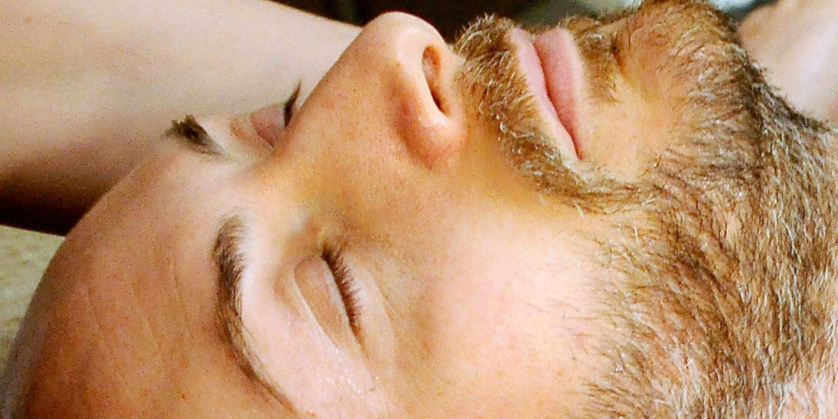 Microneedling