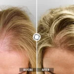 Peptide Hair Growth Serum