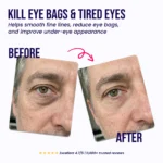 Oros Under-Eye Repair Patches
