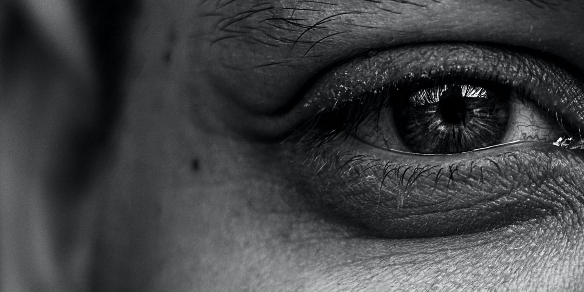 Tired eyes